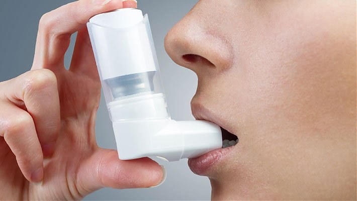 What are Steroid Inhalers for Asthma?